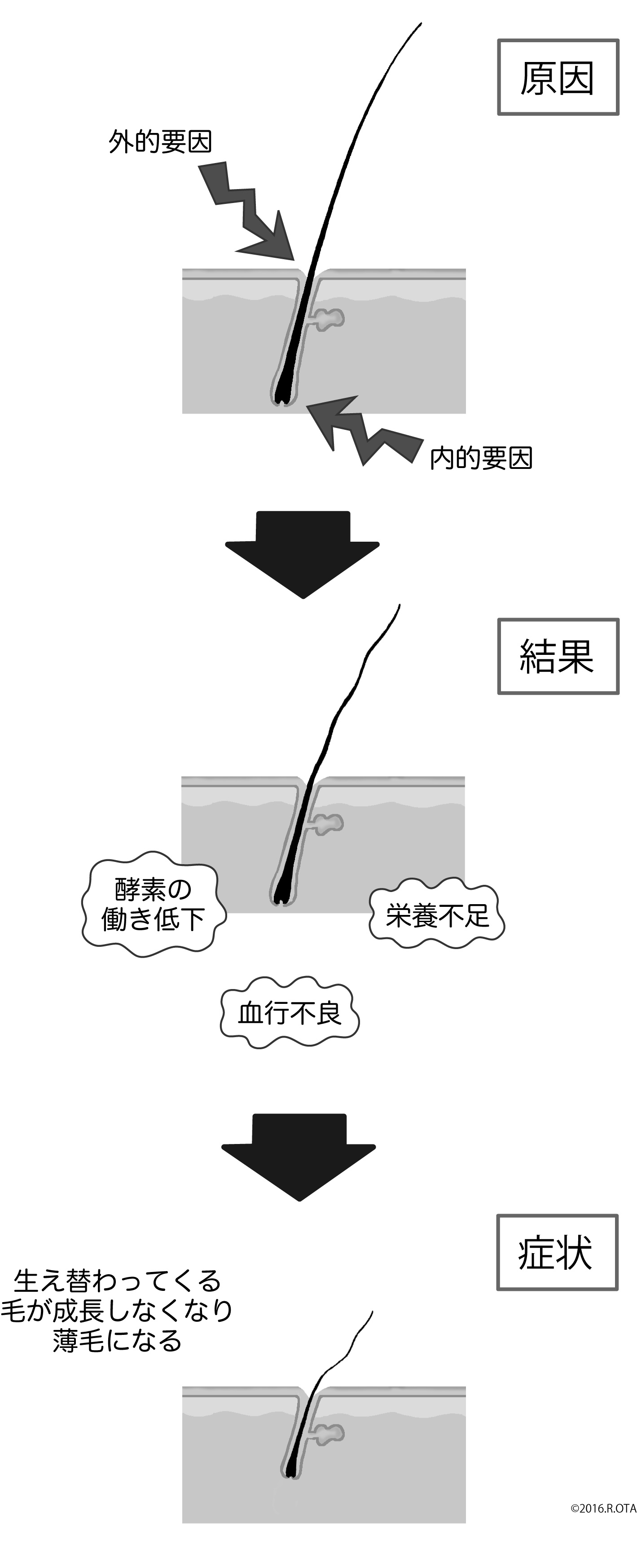 原因・結果・症状